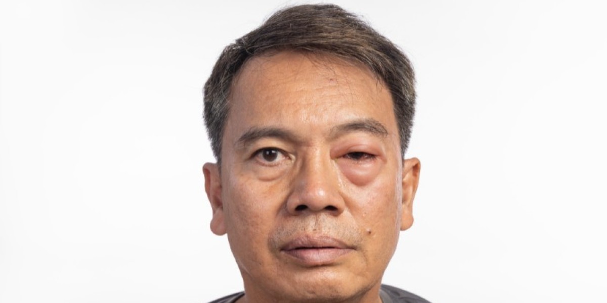 Hereditary Angioedema Therapeutics Market Report 2034
