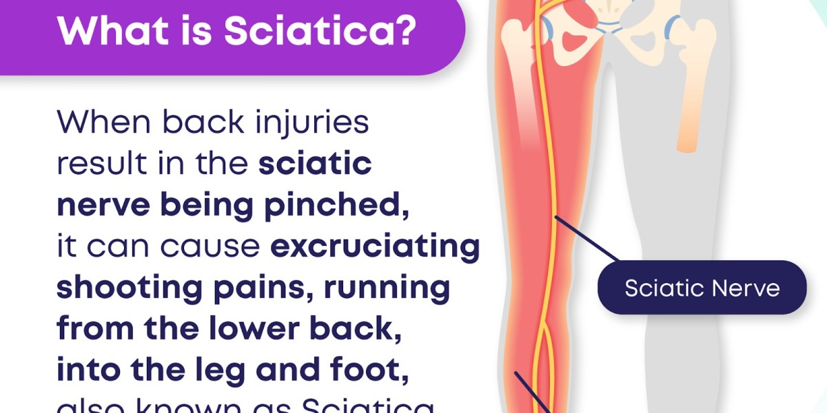 Sciatic Pain Relief in the US & Canada: Non-Surgical Solutions That Work