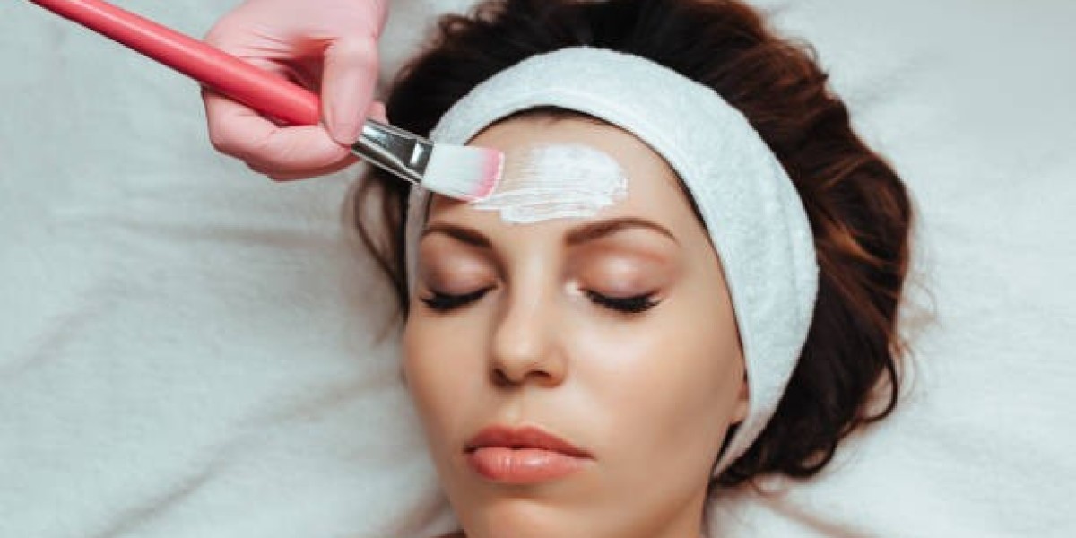 Chemical Peels for Gentle Yet Effective Skin Care