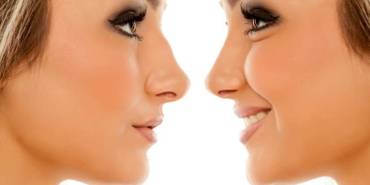 Post-Rhinoplasty Makeup Guide: When and How to Apply Safely