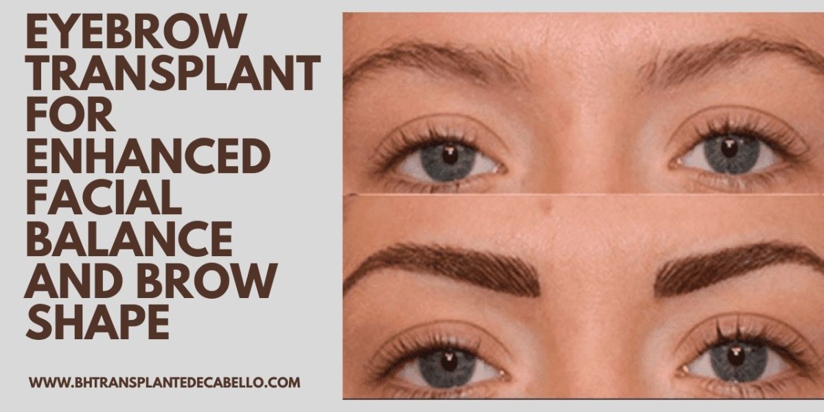 Eyebrow Transplant for Enhanced Facial Balance and Brow Shape