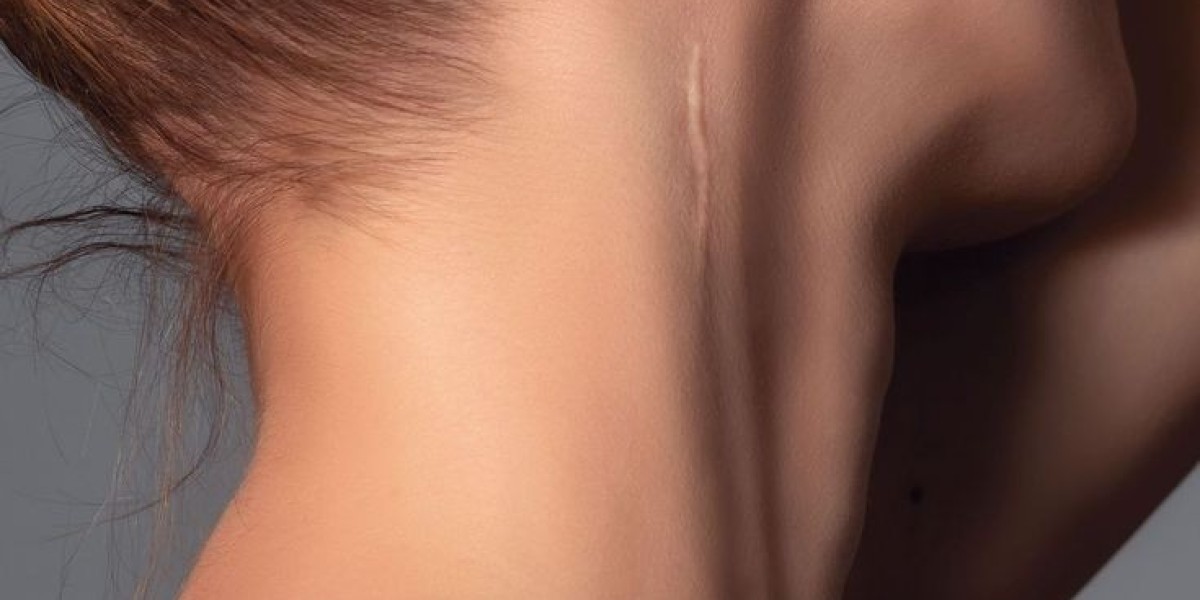 Advanced Skin Therapies for Wart-Free Confidence