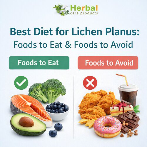 Best Diet for Lichen Planus: Foods to Eat & Foods to Avoid
