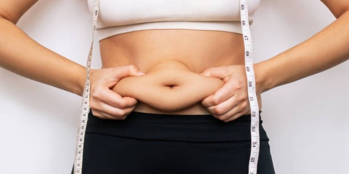 Who Is an Ideal Candidate for Liposuction in Riyadh?