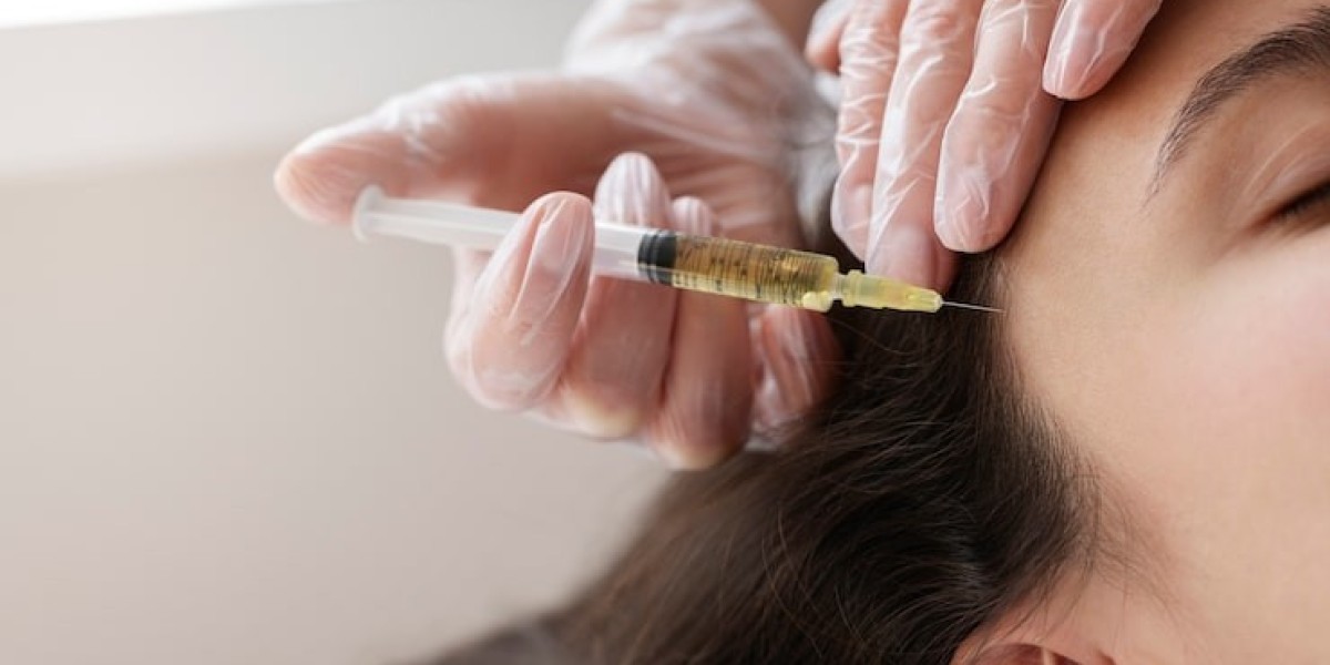 PRP Hair Treatment for Stress-Related Hair Loss: Does It Work?