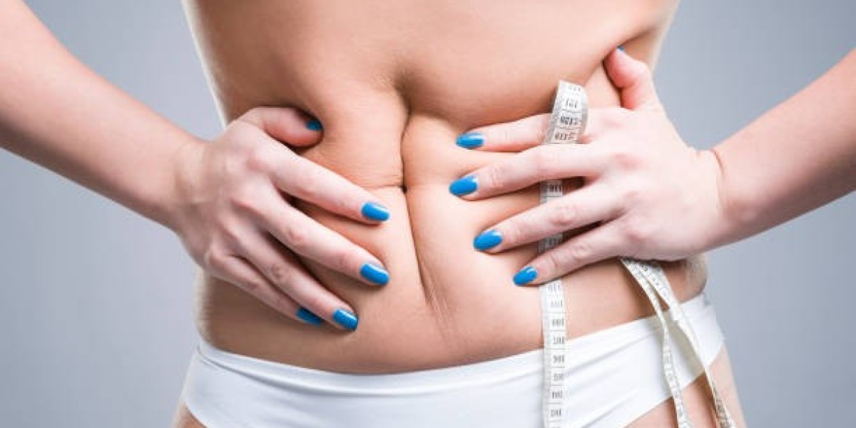 Can Liposuction Refine Postpartum C-Section Pouches?