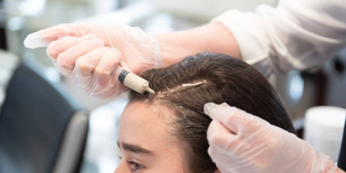 Safe PRP Therapy Protocols for Hair Loss in Riyadh Practices