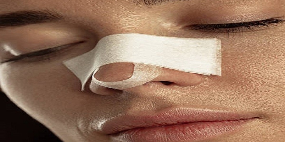 What You Should Know About Rhinoplasty Recovery in Riyadh